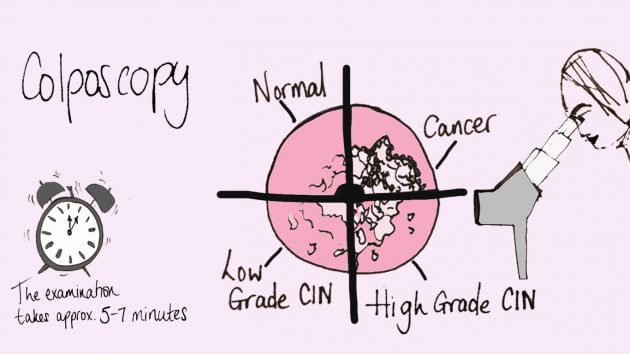 What happens during and after a colposcopy